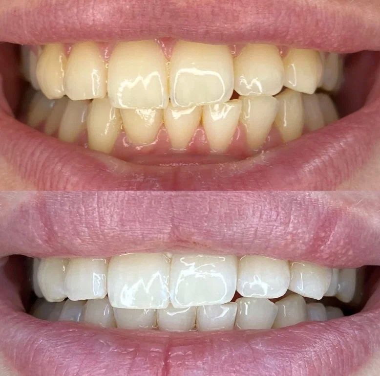 Ортодонтическая стоматология